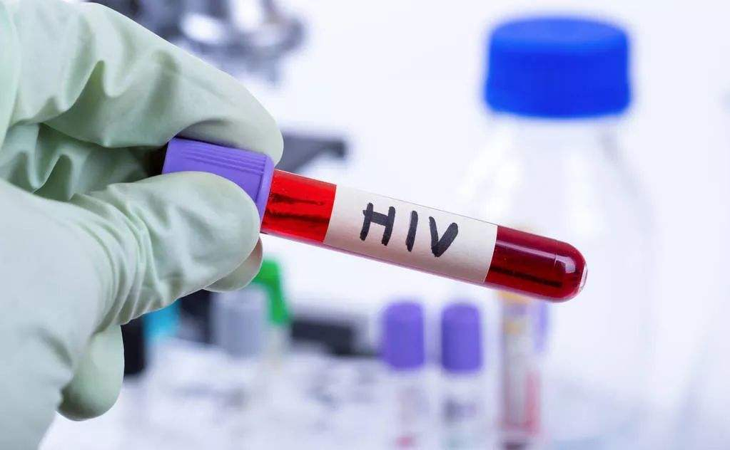 艾滋HIV确诊/确证实验，免疫印迹法（蛋白条带/蛋白膜条法）